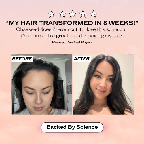Lumera™ HairStim Pro : Advanced Scalp Renewal