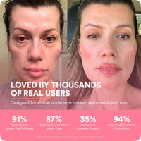 EyeNova™ 2-in-1 Red Light Therapy + EMS Eye Device