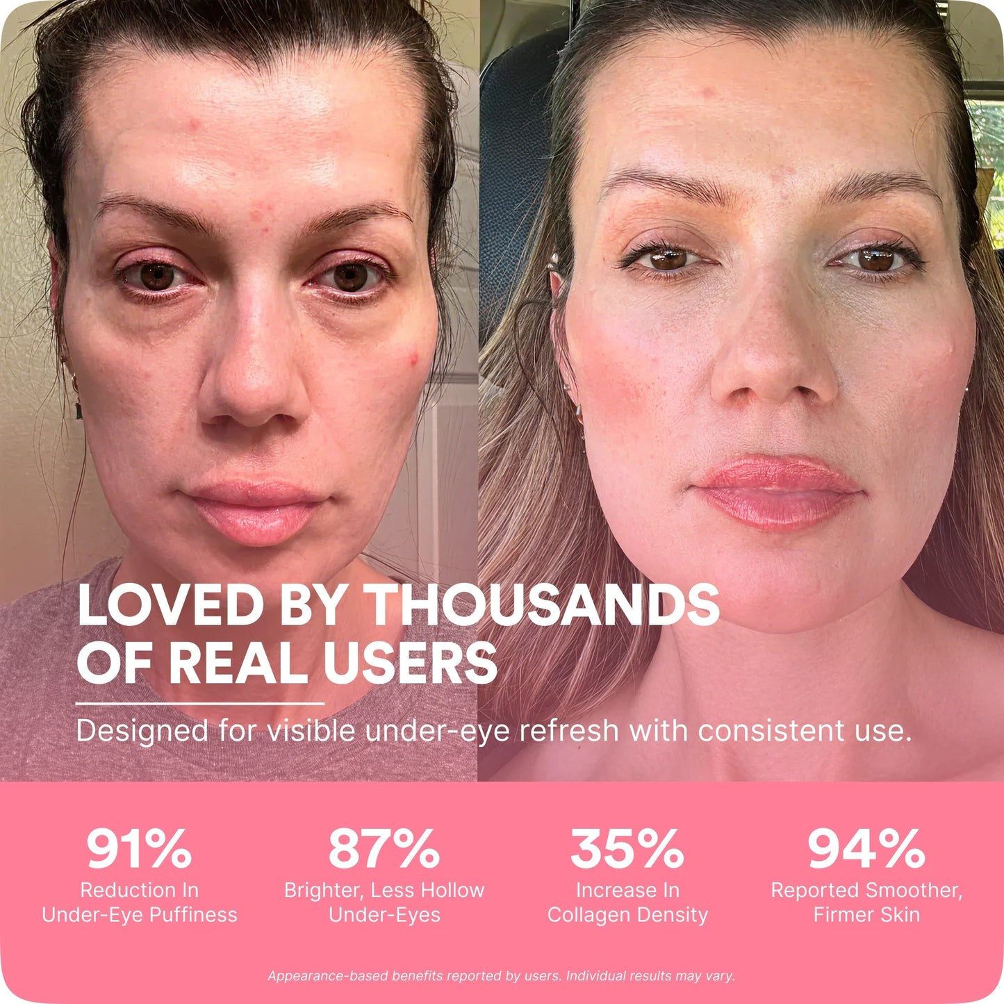 EyeNova™ 2-in-1 Red Light Therapy + EMS Eye Device